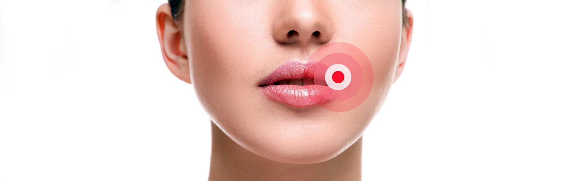 How to treat swollen lips allergic reaction